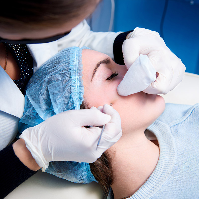 Skincare untuk Kulit Berjerawat